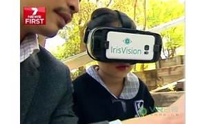 通过来自IrisVision的援助 黄斑变性女孩的视力将得到矫正