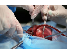 世界首例猪肾脏移植人体手术成功 未发生排异现象